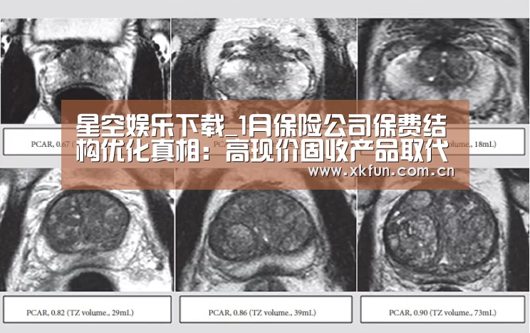 星空娱乐下载_1月保险公司保费结构优化真相:高现价固收产品取代万能险(图2) 星空娱乐下载
